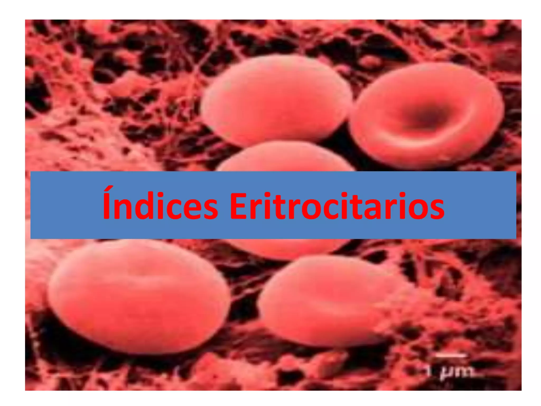 Índices Eritrocitarios
 