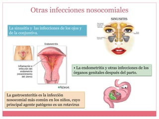 Otras infecciones nosocomiales 
La sinusitis y las infecciones de los ojos y 
de la conjuntiva. 
• La endometritis y otras infecciones de los 
órganos genitales después del parto. 
La gastroenteritis es la infección 
nosocomial más común en los niños, cuyo 
principal agente patógeno es un rotavirus 
 