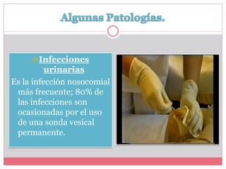 Infecciones 
urinarias 
Es la infección nosocomial 
más frecuente; 80% de 
las infecciones son 
ocasionadas por el uso 
de una sonda vesical 
permanente. 
 