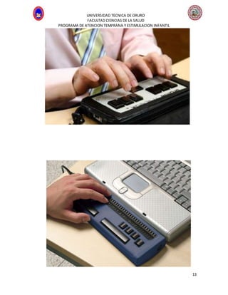UNIVERSIDAD TECNICA DE ORURO
FACULTAD CIENCIAS DE LA SALUD
PROGRAMA DE ATENCION TEMPRANA Y ESTIMULACION INFANTIL
13
 