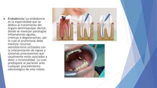  Endodoncia: La endodoncia
es la especialidad que se
dedica al tratamiento del
órgano dentinopulpar dental,
donde se mane...