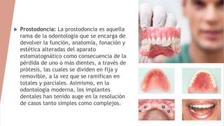  Prostodoncia: La prostodoncia es aquella
rama de la odontología que se encarga de
devolver la función, anatomía, fonació...