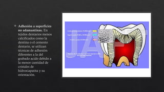  Adhesión a superficies
no adamantinas. En
tejidos dentarios menos
calcificados como la
dentina o el cemento
dentario, se utilizan
técnicas de adhesión
diferentes a la del
grabado acido debido a
la menor cantidad de
cristales de
hidroxiapatita y su
orientación.
 