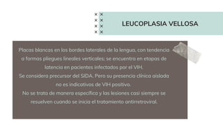 LEUCOPLASIA VELLOSA
Placas blancas en los bordes laterales de la lengua, con tendencia
a formas pliegues lineales verticales; se encuentra en etapas de
latencia en pacientes infectados por el VIH.
Se considera precursor del SIDA. Pero su presencia clínica aislada
no es indicativos de VIH positivo.
No se trata de manera específica y las lesiones casi siempre se
resuelven cuando se inicia el tratamiento antirretroviral.
 