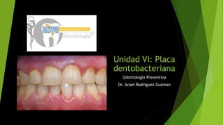 Unidad VI: Placa
dentobacteriana
Odontología Preventiva
Dr. Israel Rodriguez Guzman
 