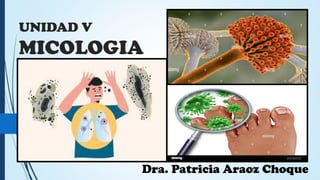 UNIDAD V
MICOLOGIA
Dra. Patricia Araoz Choque
 