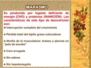 MARASMO
Es producido por ingesta deficiente de
energía (CHO) y proteínas (INANICIÓN). Las
características de este tipo de desnutrición
son:
♣ Interrupción completa del crecimiento

♣ Pérdida total del tejido graso subcutáneo

♣ Atrofia de la musculatura: brazos y piernas en
“palo de escoba”

♣ Cara arrugada

♣ Sin edema

♣ Sin hepatomegalia
 