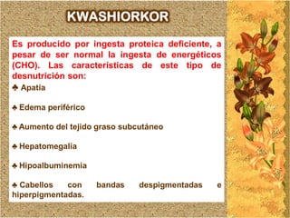 KWASHIORKOR

Es producido por ingesta proteica deficiente, a
pesar de ser normal la ingesta de energéticos
(CHO). Las características de este tipo de
desnutrición son:
♣ Apatía

♣ Edema periférico

♣ Aumento del tejido graso subcutáneo

♣ Hepatomegalia

♣ Hipoalbuminemia

♣ Cabellos   con     bandas    despigmentadas   e
hiperpigmentadas.
 