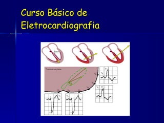 Curso Básico de Eletrocardiografia 