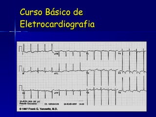 Curso Básico de Eletrocardiografia 