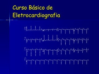 Curso Básico de Eletrocardiografia 