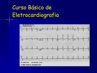Curso Básico de Eletrocardiografia 