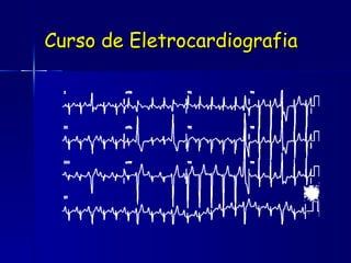 Curso de Eletrocardiografia 