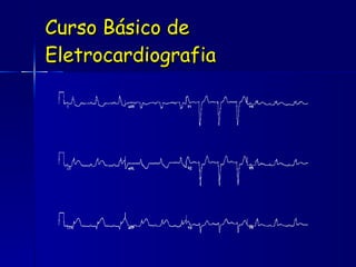Curso Básico de Eletrocardiografia 