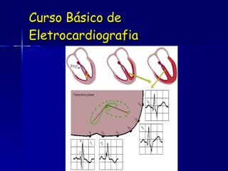 Curso Básico de Eletrocardiografia 