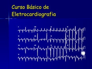 Curso Básico de Eletrocardiografia 