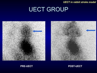 UECT GROUP PRE-UECT POST-UECT 