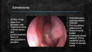 Schwannoma
• 25-55yr of age
• Arise from
Schwanncells
• Trigeminal nerve
,Carotid plexus
and
parasympathetic
fibers of
pterygopalatine
ganglion
• Well delineated,
unencapuslated
• Globular
• Firm torubbery
yellow tumor
• Antoni Aand B
bodies
• Endoscopyshows
network of fine
capillaries giving
image ofvascular
tumor.
 