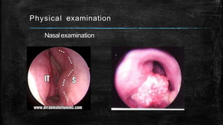 Physical examination
Nasalexamination
 