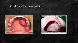 Oral cavity examination
 