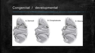 Congenital / developmental
 
