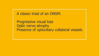 A classic triad of an ONSM:
Progressive visual loss
Optic nerve atrophy
Presence of optociliary collateral vessels
 