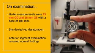On examination…
• Hertel measurements were 15
mm OD and 16 mm OS with a
base of 105 mm.
• She denied red desaturation.
• Anterior segment examination
revealed normal findings
 