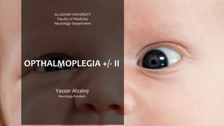 OPTHALMOPLEGIA +/- II
Yasser Alzainy
Neurology Resident
AL-AZHAR UNIVERSITY
Faculty of Medicine
Neurology Department
 