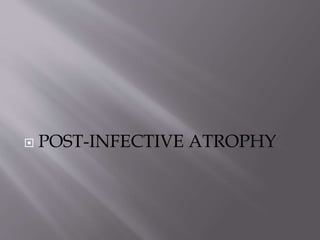  POST-INFECTIVE ATROPHY
 