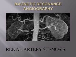 RENAL ARTERY STENOSIS
 