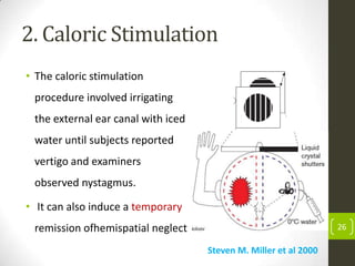 2. Caloric Stimulation
• The caloric stimulation

procedure involved irrigating
the external ear canal with iced
water until subjects reported
vertigo and examiners
observed nystagmus.
• It can also induce a temporary
remission ofhemispatial neglect

26

Steven M. Miller et al 2000

 