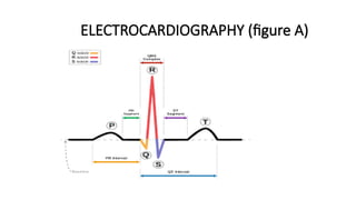 ELECTROCARDIOGRAPHY (figure A)
 