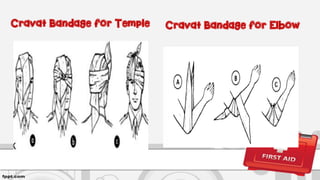 Cravat Bandage for ElbowCravat Bandage for Temple
 