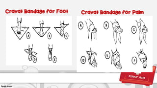 Cravat Bandage for PalmCravat Bandage for Foot
 