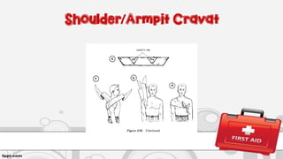 Shoulder/Armpit Cravat
 