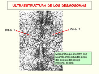 ULTRAESTRUCTURA DE LOS DESMOSOMAS
Micrografía que muestra tres
Desmosomas situados entre
dos células del epitelio
intestinal de rata
Célula 2Célula 1
 