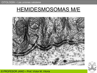 HEMIDESMOSOMAS M/E 