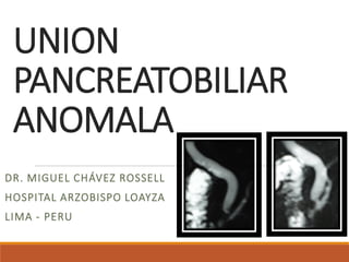 UNION PANCREATOBILIAR ANOMALA 
DR. MIGUEL CHÁVEZ ROSSELL 
HOSPITAL ARZOBISPO LOAYZA 
LIMA -PERU  