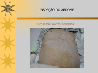 Circulação Colateral Abdominal INSPEÇÃO DO ABDOME 