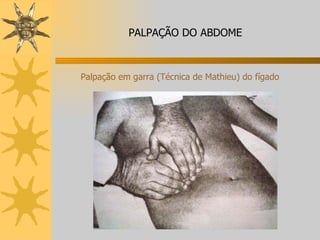 Palpação em garra (Técnica de Mathieu) do fígado PALPAÇÃO DO ABDOME 