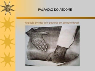 Palpação do baço com paciente em decúbito dorsal PALPAÇÃO DO ABDOME 