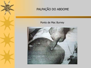 Ponto de Mac Burney PALPAÇÃO DO ABDOME 