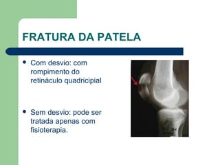 FRATURA DA PATELA
 Com desvio: com
rompimento do
retináculo quadricipial
 Sem desvio: pode ser
tratada apenas com
fisioterapia.
 