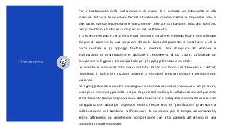 Per il trattamento della malocclusione di classe III è indicato un intervento in età
infantile. Tuttavia, le maschere facc...
