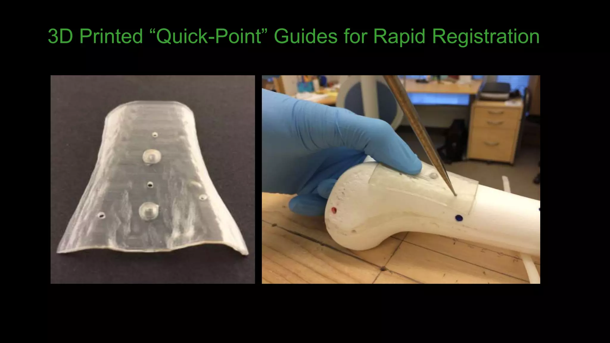 3D Printed “Quick-Point” Guides for Rapid Registration
 