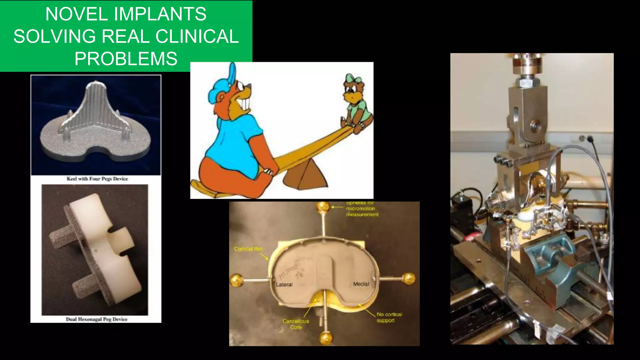 NOVEL IMPLANTS
SOLVING REAL CLINICAL
PROBLEMS
 