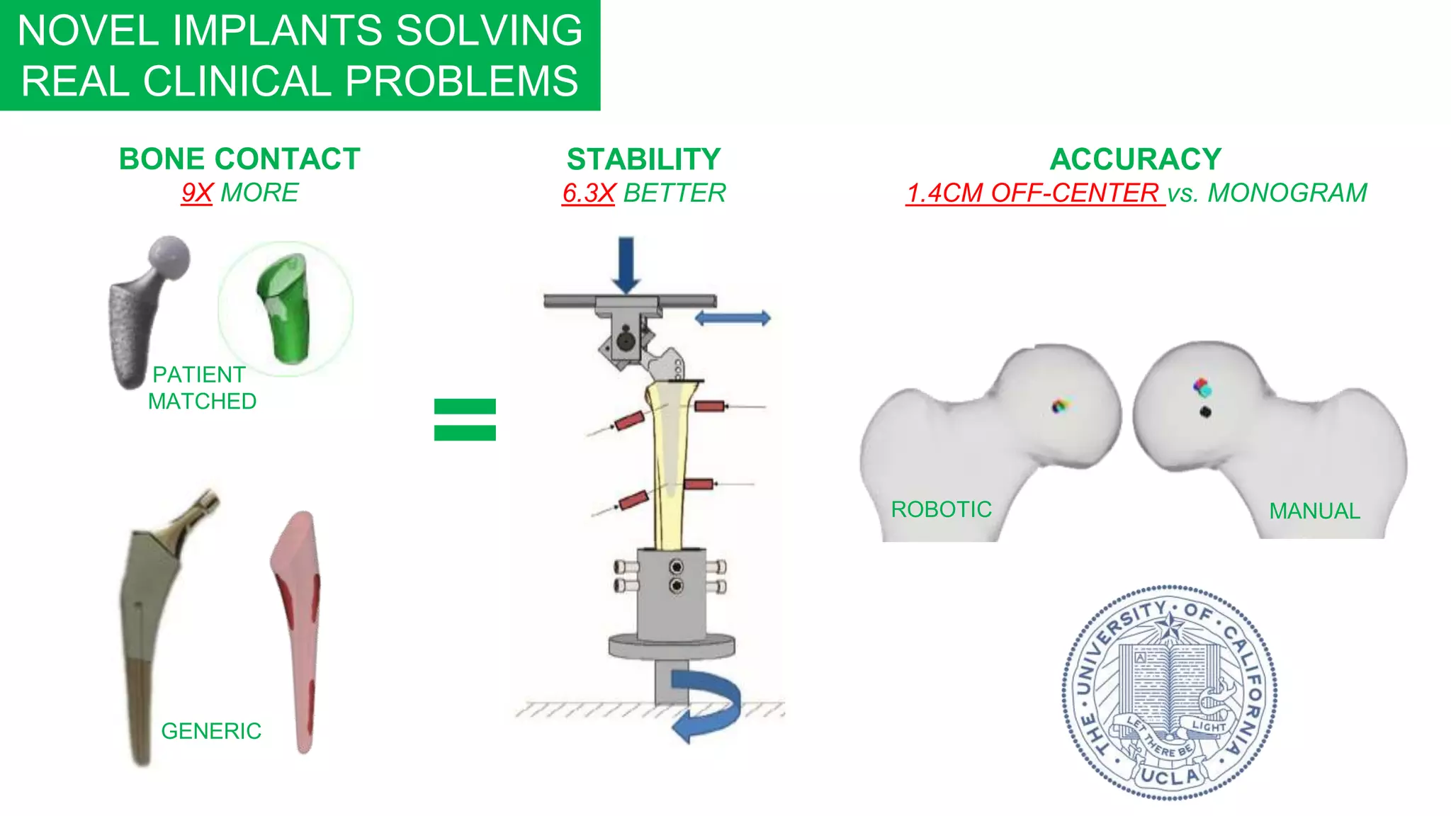 NOVEL IMPLANTS SOLVING
REAL CLINICAL PROBLEMS
GENERIC
BONE CONTACT
9X MORE
ACCURACY
1.4CM OFF-CENTER vs. MONOGRAM
STABILITY
6.3X BETTER
ROBOTIC MANUAL
PATIENT
MATCHED
=
 