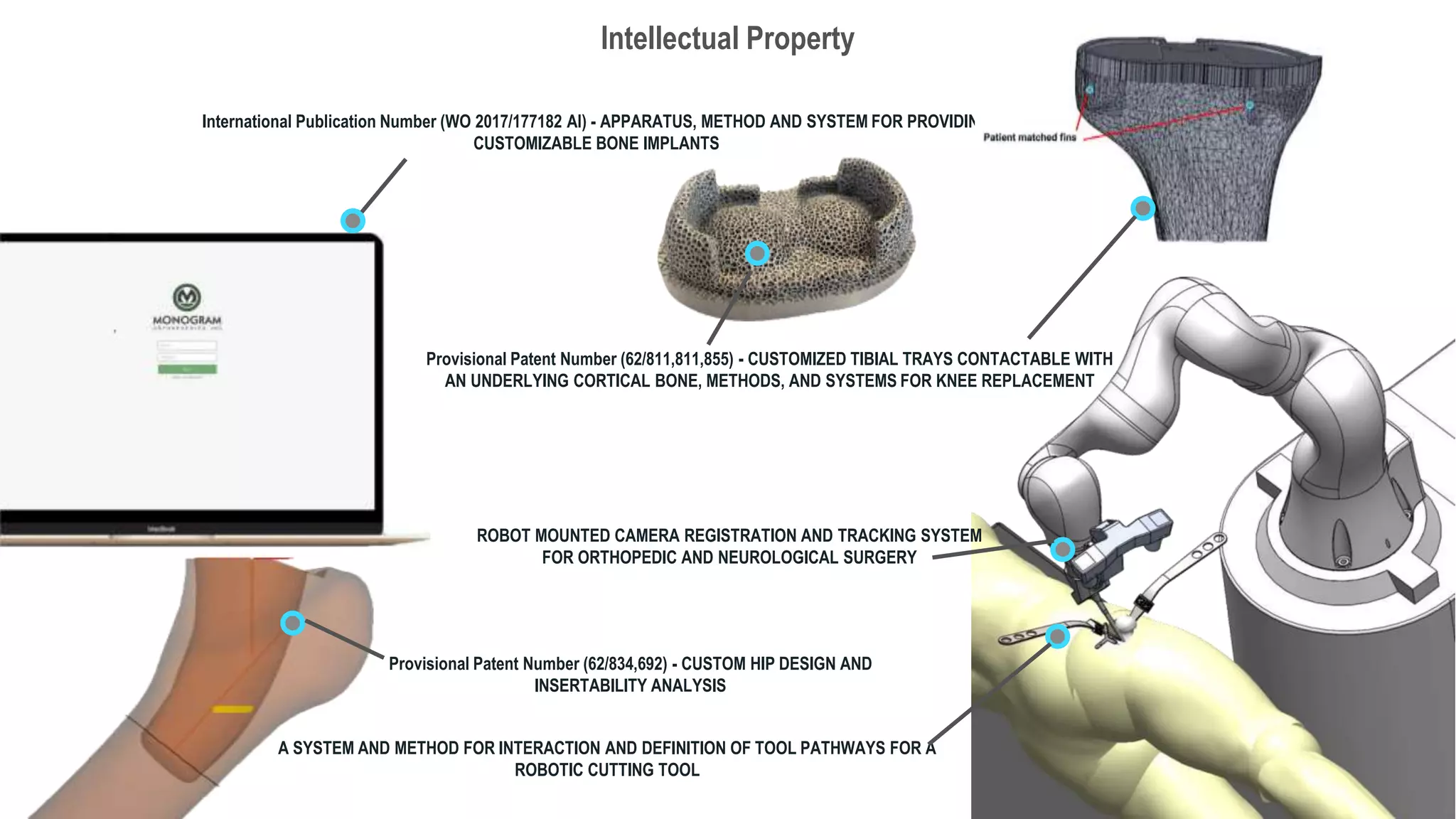 Intellectual Property
International Publication Number (WO 2017/177182 Al) - APPARATUS, METHOD AND SYSTEM FOR PROVIDING
CUSTOMIZABLE BONE IMPLANTS
Provisional Patent Number (62/811,811,855) - CUSTOMIZED TIBIAL TRAYS CONTACTABLE WITH
AN UNDERLYING CORTICAL BONE, METHODS, AND SYSTEMS FOR KNEE REPLACEMENT
Provisional Patent Number (62/834,692) - CUSTOM HIP DESIGN AND
INSERTABILITY ANALYSIS
ROBOT MOUNTED CAMERA REGISTRATION AND TRACKING SYSTEM
FOR ORTHOPEDIC AND NEUROLOGICAL SURGERY
A SYSTEM AND METHOD FOR INTERACTION AND DEFINITION OF TOOL PATHWAYS FOR A
ROBOTIC CUTTING TOOL
 