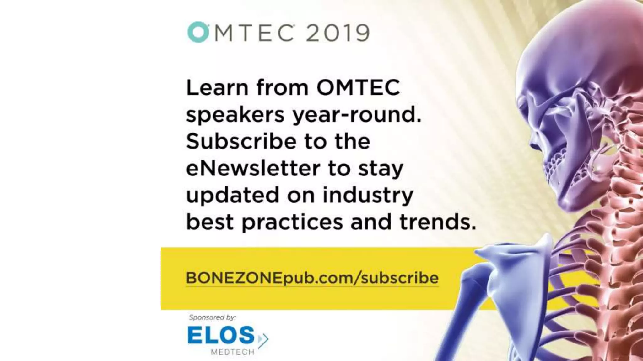 The Future of Personalized Implants in Joint Replacement: Additive, Robotics, Augmented Reality