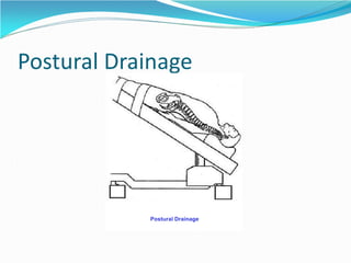 Postural Drainage
Postural Drainage
 